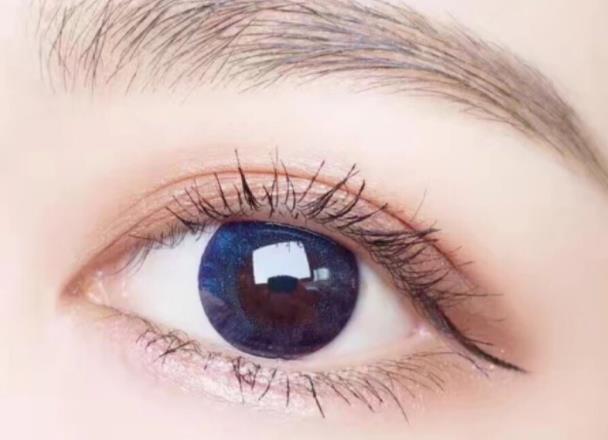 戴美瞳眼睛红了怎么回事 佩戴时间过长眼部感染